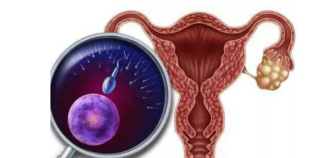 卵巢畸胎瘤的形成因揭秘：两大神秘因素揭秘！