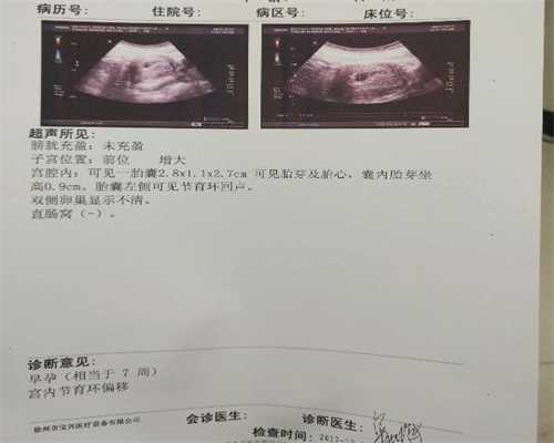 上海代孕产子费用 ：排卵期同房出血是怎么回事