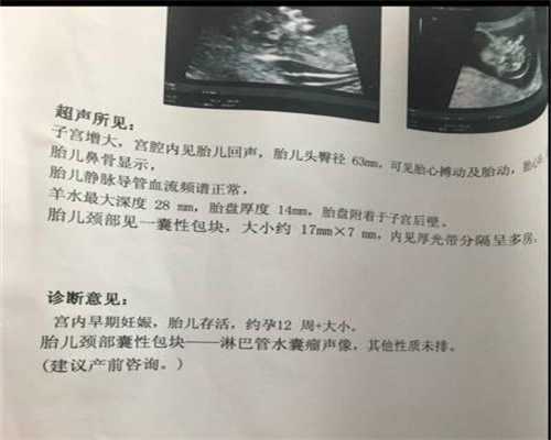 上海代孕产子：孕前排毒免费编辑添加义项名