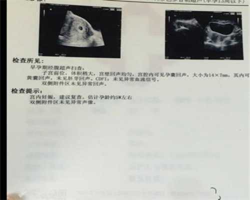 上海靠谱的代怀孕公司有哪些：南方医科大学第