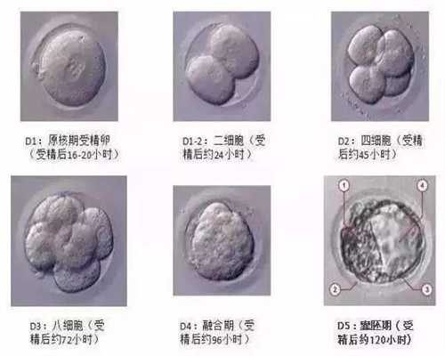 上海代孕公司网站:输卵管不通有啥症状呢