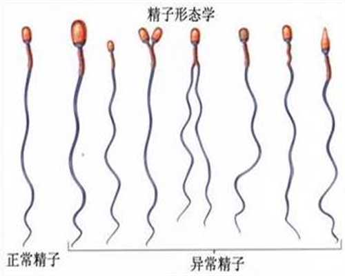 上海代孕要花多少钱:习惯性流产的发生与哪些因