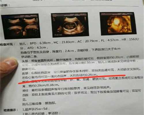 上海代孕生仔多少钱:前列腺炎诊断的一般方法