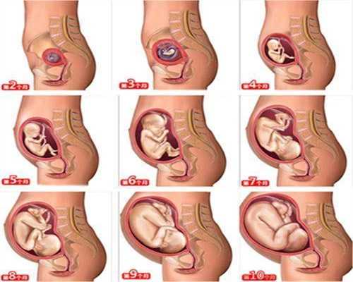 上海代孕优势:宫颈糜烂的症状会有哪些呢