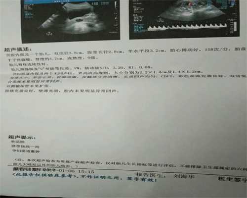 上海借卵试管婴儿总共费用_上海供卵试管_助孕机