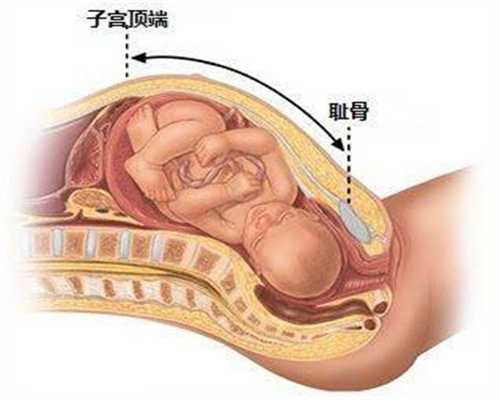 上海代孕需要哪些条件呢_上海试管婴儿代怀生子
