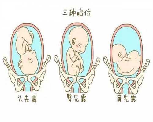 上海哪有供卵机构-为什么有代孕公司
