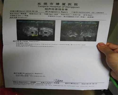 上海代生一个孩子要多少钱，宝宝长湿疹可以打预防针吗