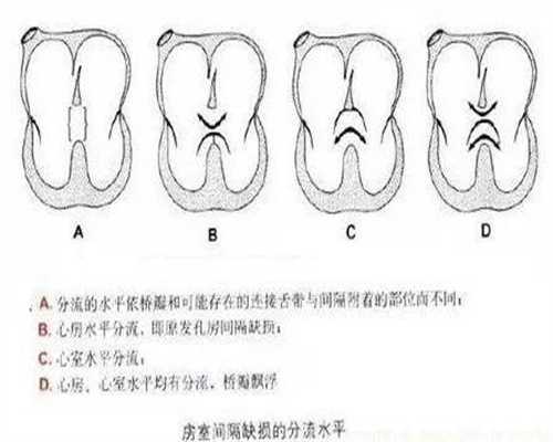 上海代怀双胞胎费用，为什么精子过少会造成**夫妇不孕