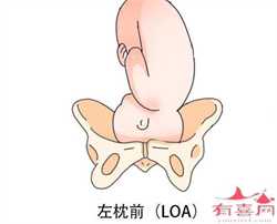 上海地下供卵机构~上海地下供卵哪家靠谱，孕妇产前腰疼怎么回事
